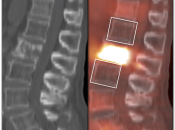 Case 5 (Image 1)