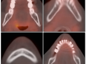 Case 1 (Image 1)