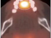 Case 2 (Image 1)