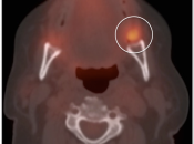 Case 3 (Image 1)