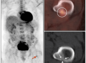 Case 1 (Image 1)
