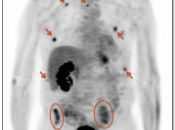 Case 2 (Image 1)