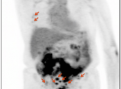 Case 3 (Image 1)