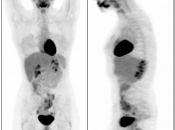 Case 1 (Image 1)
