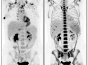 Case 3 (Image 1)