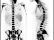 Case 4 (Image 1)