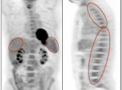 Case 5 (Image 1)