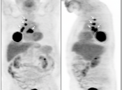 Case 1 (Image 1)