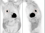 Case 6 (Image 1)