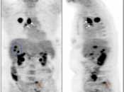 Case 3 (Image 1)