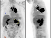 Case 4 (Image 1)
