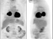 Case 8 (Image 1)