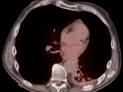 Case 10 (Image 1)