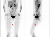 Case 1 (Image 1)