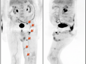 Case 2 (Image 1)