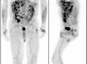 Case 4 (Image 1)