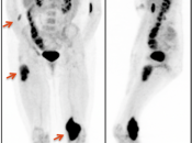Case 5 (Image 1)