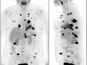 Case 6 (Image 1)