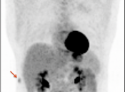 Case 9 (Image 1)