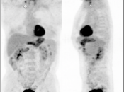 Case 1 (Image 1)