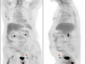 Case 2 (Image 1)