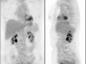 Case 3 (Image 1)