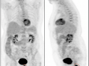 Case 4 (Image 1)