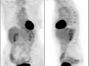 Case 5 (Image 1)