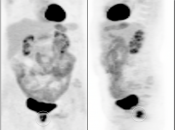 Case 6 (Image 1)