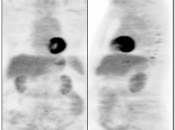 Case 7 (Image 1)