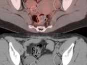 Case 1 (Image 1)