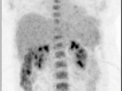 Case 2 (Image 1)