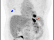 Case 4 (Image 1)