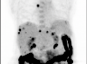 Case 5 (Image 1)