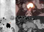 Case 1 (Image 1)