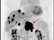 Case 2 (Image 1)