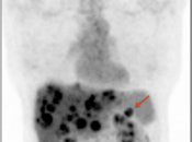 Case 4 (Image 1)