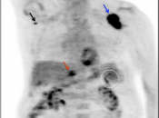 Case 6 (Image 1)