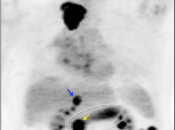 Case 8 (Image 1)