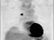 Case 1 (Image 1)