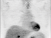 Case 5 (Image 1)
