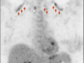 Case 6 (Image 1)
