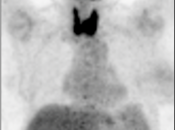Case 7 (Image 1)