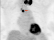 Case 9 (Image 1)
