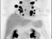 Case 11 (Image 1)