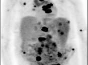 Case 12 (Image 1)