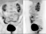 Case 1 (Image 1)