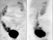 Case 2 (Image 1)
