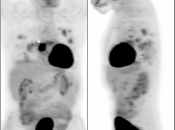 Case 3 (Image 1)