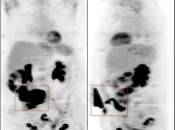 Case 5 (Image 1)